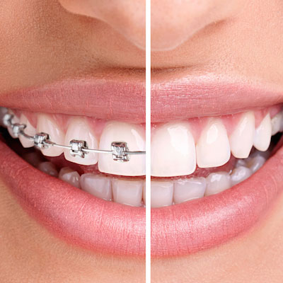 Cookeville Orthodontia